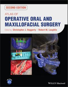Atlas of Operative Oral and Maxillofacial Surgery (2nd Edition)
