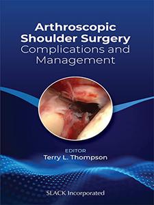 Arthroscopic Shoulder Surgery Complications and Management