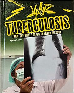 Tuberculosis How the White Death Changed History