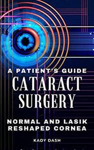 A Patient's Guide to Cataract Surgery Normal and LASIK Reshaped Cornea