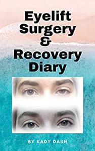 Eyelift Surgery and Recovery Diary Ptosis, eyelifts, punctal plugs, and dry eyes