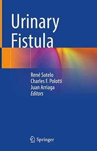 Urinary Fistula