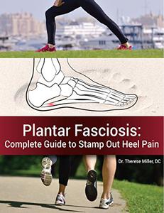 Plantar Fasciosis The Complete Guide to Stamping Out Heel Pain
