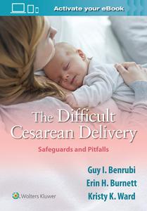 The Difficult Cesarean Delivery Safeguards and Pitfalls