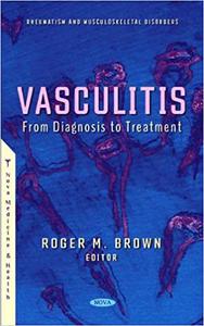 Vasculitis From Diagnosis to Treatment
