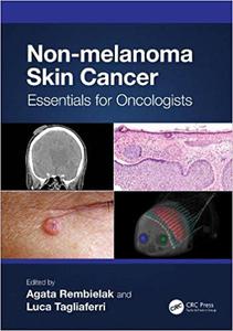 Non-melanoma Skin Cancer Essentials for Oncologists