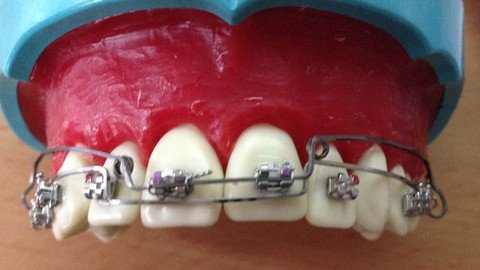 Specialist View On Orthodontic Patient Management