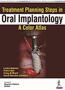 Treatment Planning Steps in Oral Implantology A Color Atlas