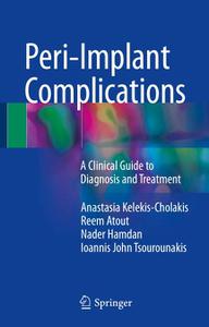 Peri– Implant Complications A Clinical Guide to Diagnosis and Treatment