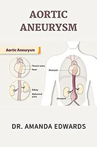 AORTIC ANEURYSM  Signs, Symptoms