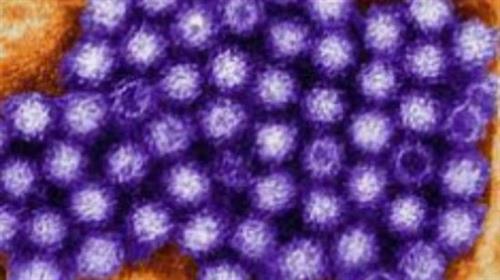 A Short Course About Norovirus ( Winter Vomiting Bug)