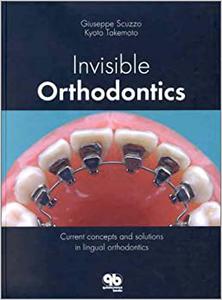 Invisible Orthodontics Current Concepts and Solutions in Lingual Orthodontics
