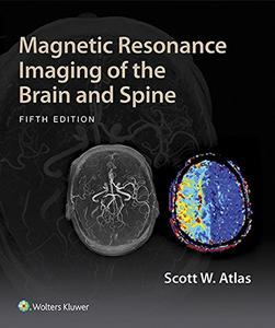 Magnetic Resonance Imaging of the Brain and Spine 