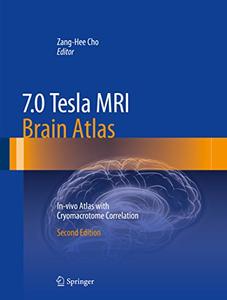 7.0 Tesla MRI Brain Atlas In-vivo Atlas with Cryomacrotome Correlation 