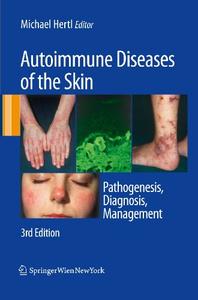 Autoimmune Diseases of the Skin Pathogenesis, Diagnosis, Management