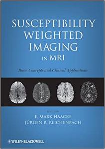 Susceptibility Weighted Imaging in MRI Basic Concepts and Clinical Applications 