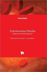 Arteriovenous Fistulas Diagnosis and Management