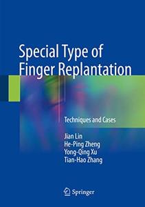 Special Type of Finger Replantation Techniques and Cases 