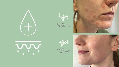 Adult Acne Skincare For Clear Skin