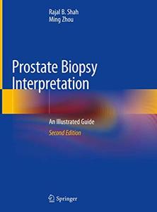 Prostate Biopsy Interpretation An Illustrated Guide