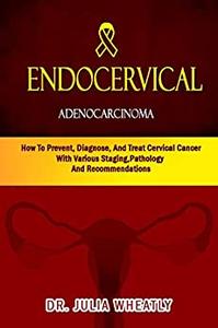 Endocervical Adenocarcinoma