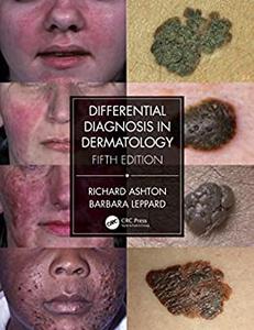 Differential Diagnosis in Dermatology (5th Edition)