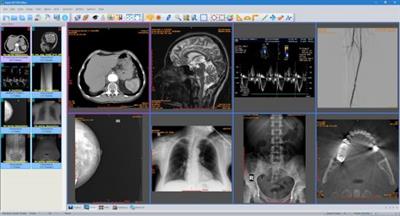 Sante DICOM Editor  8.2