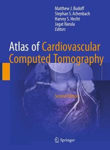 Atlas of Cardiovascular Computed Tomography, Second Edition 