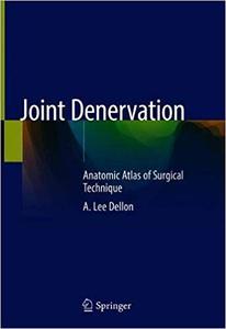 Joint Denervation An Atlas of Surgical Techniques 