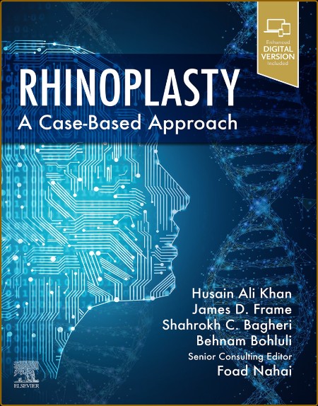 Rhinoplasty A Case-Based Approach Eadd0ff158c3a4b9393ac3a192e9018d