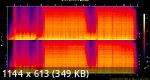 15. Keeno - Brave Face.flac.Spectrogram.png